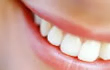 ijoven_dientes.jpg